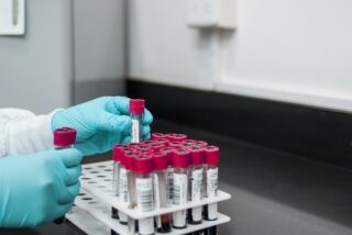 Precision Dispensers and the Push Toward Greener Laboratory Practices